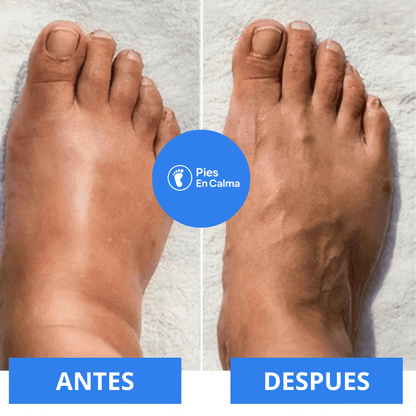 Pack Alivio Nocturno Pro – Activación Muscular EMS para Pies